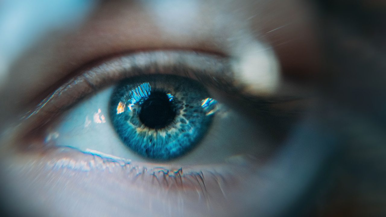 Seonix Bio | SightScore™ | Genetic Glaucoma Risk Prediction