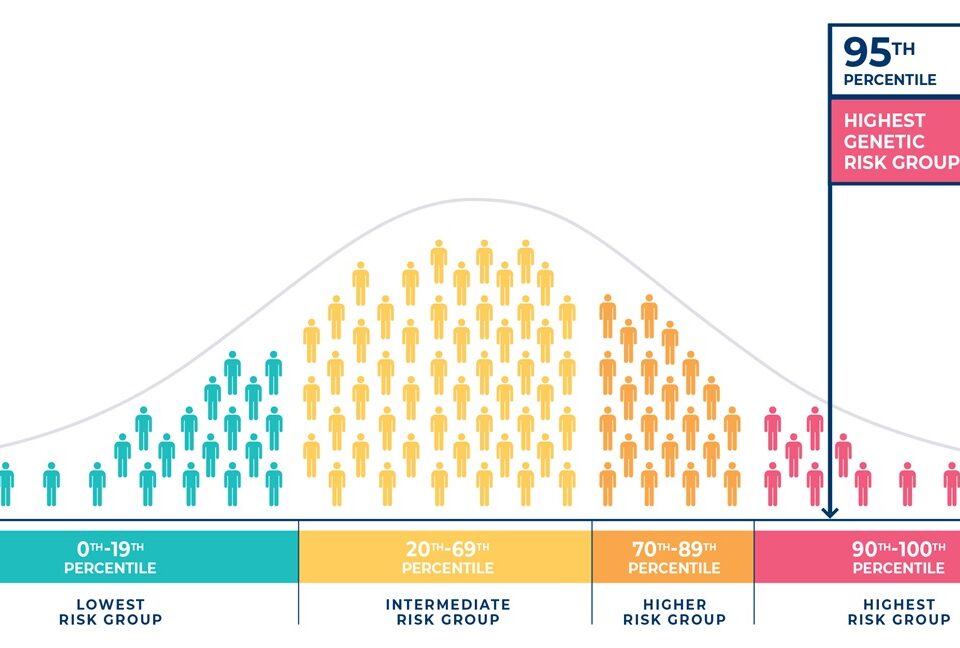 Seonix Bio | SightScore™ | Genetic Glaucoma Risk Prediction